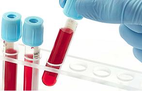 Blood Test 01